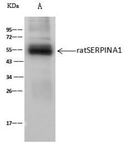 Invitrogen alpha-1 Antitrypsin Polyclonal Antibody 100 &mu;L; Unconjugated:Antibodies,