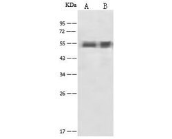 Invitrogen alpha-1 Antitrypsin Polyclonal Antibody 100 &mu;L; Unconjugated:Antibodies,