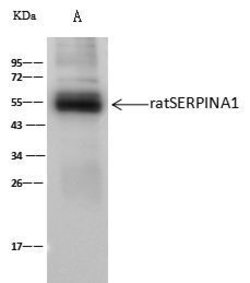 Invitrogen alpha-1 Antitrypsin Polyclonal Antibody 100 &mu;L; Unconjugated:Antibodies,