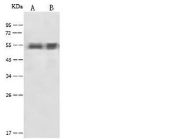 Invitrogen alpha-1 Antitrypsin Polyclonal Antibody 100 &mu;L; Unconjugated:Antibodies,