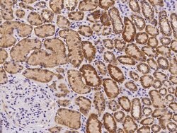 Invitrogen ORNT1 Polyclonal Antibody 100 μL; Unconjugated:Antibodies,