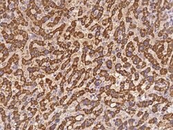 Invitrogen ORNT1 Polyclonal Antibody 100 μL; Unconjugated:Antibodies,