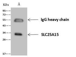 Invitrogen ORNT1 Polyclonal Antibody 100 μL; Unconjugated:Antibodies,