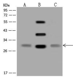 Invitrogen ORNT1 Polyclonal Antibody 100 μL; Unconjugated:Antibodies,