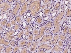 Invitrogen SNX8 Polyclonal Antibody 100 &mu;L; Unconjugated:Antibodies,