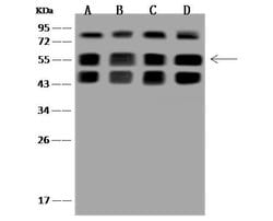Invitrogen SNX8 Polyclonal Antibody 100 &mu;L; Unconjugated:Antibodies,