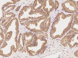 Invitrogen HIP Polyclonal Antibody 100 &mu;L; Unconjugated:Antibodies,