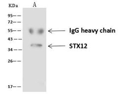 STX12 Polyclonal Antibody:Antibodies, Polyclonal