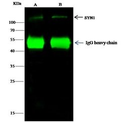 Invitrogen Synapsin 1 Polyclonal Antibody 100 μL; Unconjugated:Antibodies,