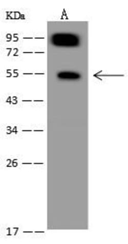 Invitrogen SYNC Polyclonal Antibody 100 &mu;L | Buy Online | Invitrogen&trade; | Fisher Scientific