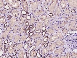 SYT12 Polyclonal Antibody:Antibodies, Polyclonal