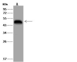 SYT12 Polyclonal Antibody:Antibodies, Polyclonal