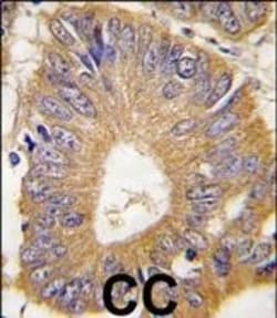Invitrogen 4EBP1 Polyclonal Antibody 400 μL; Unconjugated:Antibodies,