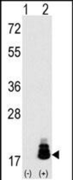 Invitrogen 4EBP1 Polyclonal Antibody 400 μL; Unconjugated:Antibodies,