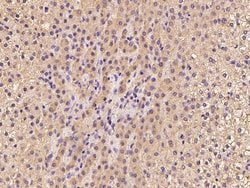 Invitrogen TBCE Polyclonal Antibody 100 μL; Unconjugated:Antibodies,