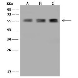 Invitrogen TBCE Polyclonal Antibody 100 μL; Unconjugated:Antibodies,