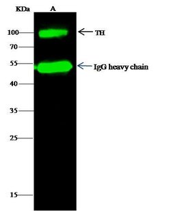 Invitrogen Tyrosine Hydroxylase Polyclonal Antibody 100 &mu;L; Unconjugated:Antibodies,