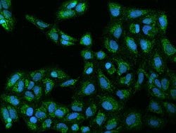 Invitrogen C19orf52 Polyclonal Antibody 100 μL; Unconjugated:Antibodies,
