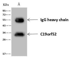 Invitrogen C19orf52 Polyclonal Antibody 100 μL; Unconjugated:Antibodies,