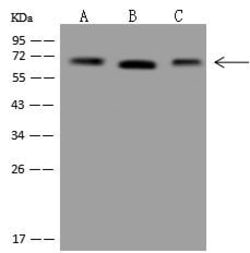 Invitrogen Transketolase Polyclonal Antibody 100 &mu;L; Unconjugated:Antibodies,