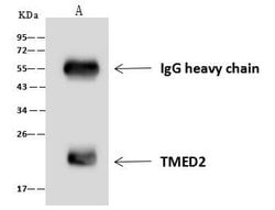 Invitrogen TMED2 Polyclonal Antibody 100 &mu;L; Unconjugated:Antibodies,