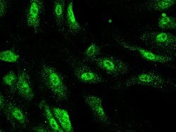 Invitrogen TRIM37 Polyclonal Antibody 100 &mu;L; Unconjugated:Antibodies,