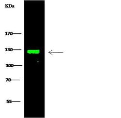 Invitrogen TRIM37 Polyclonal Antibody 100 &mu;L; Unconjugated:Antibodies,