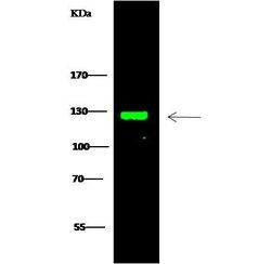 Invitrogen TRIM37 Polyclonal Antibody 100 &mu;L; Unconjugated:Antibodies,