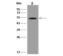 Invitrogen TTC23 Polyclonal Antibody 100 &mu;L | Buy Online | Invitrogen&trade; | Fisher Scientific