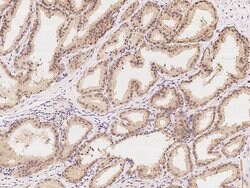 Invitrogen TTLL12 Polyclonal Antibody 100 &mu;L; Unconjugated:Antibodies,
