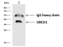 Invitrogen UBE2J1 Polyclonal Antibody 100 &mu;L; Unconjugated:Antibodies,