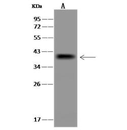 Invitrogen UBE2J1 Polyclonal Antibody 100 &mu;L; Unconjugated:Antibodies,