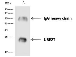 Invitrogen UBE2T Polyclonal Antibody 100 &mu;L; Unconjugated:Antibodies,