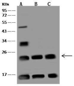 Invitrogen UBE2T Polyclonal Antibody 100 &mu;L; Unconjugated:Antibodies,