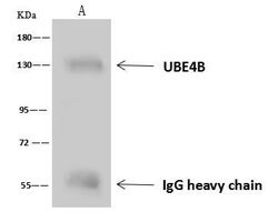 Invitrogen UBE4B Polyclonal Antibody 100 &mu;L | Buy Online | Invitrogen&trade; | Fisher Scientific