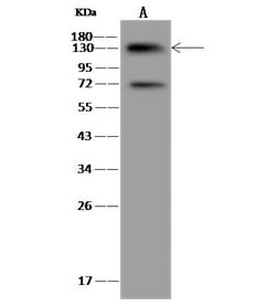 Invitrogen UBE4B Polyclonal Antibody 100 &mu;L | Buy Online | Invitrogen&trade; | Fisher Scientific