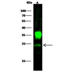 Invitrogen PGP9.5 Polyclonal Antibody 100 &mu;L; Unconjugated:Antibodies,