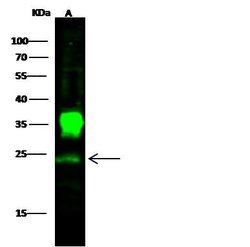 Invitrogen PGP9.5 Polyclonal Antibody 100 &mu;L; Unconjugated:Antibodies,