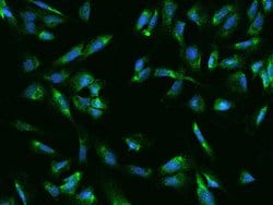 Invitrogen UCKL1 Polyclonal Antibody 100 &mu;L; Unconjugated:Antibodies,