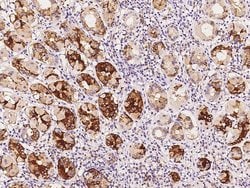 Invitrogen UCKL1 Polyclonal Antibody 100 &mu;L; Unconjugated:Antibodies,