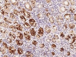 Invitrogen UCKL1 Polyclonal Antibody 100 &mu;L; Unconjugated:Antibodies,