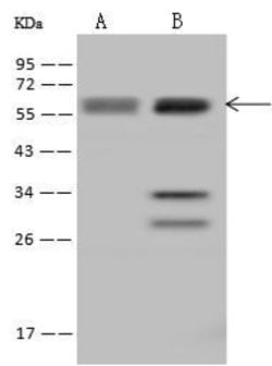 Invitrogen UCKL1 Polyclonal Antibody 100 &mu;L; Unconjugated:Antibodies,
