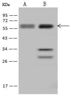 Invitrogen UCKL1 Polyclonal Antibody 100 &mu;L; Unconjugated:Antibodies,