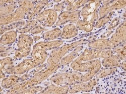 Invitrogen UEVLD Polyclonal Antibody 100 &mu;L; Unconjugated:Antibodies,
