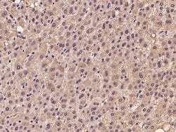 Invitrogen UEVLD Polyclonal Antibody 100 &mu;L; Unconjugated:Antibodies,
