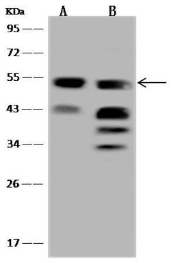 Invitrogen UGP2 Polyclonal Antibody 100 &mu;L; Unconjugated:Antibodies,