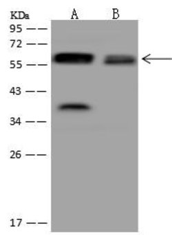Invitrogen UGT8 Polyclonal Antibody 100 μL; Unconjugated:Antibodies,