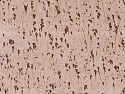 VARS Polyclonal Antibody:Antibodies, Polyclonal