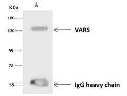 VARS Polyclonal Antibody:Antibodies, Polyclonal