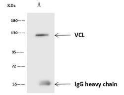 Invitrogen Vinculin Polyclonal Antibody 100 &mu;L; Unconjugated:Antikroppar